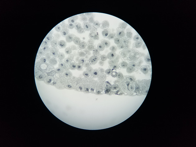 White Fish Mitosis Slides - White Fish Mitosis 14 400X